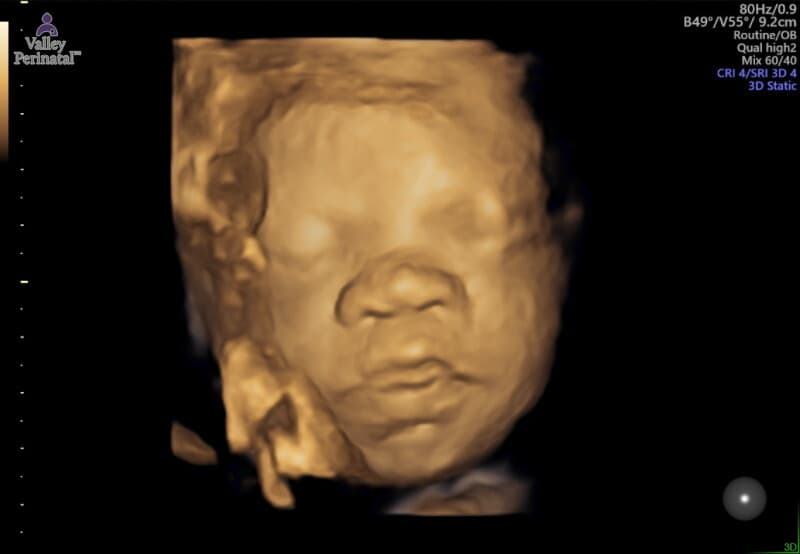 Photo of Ezra